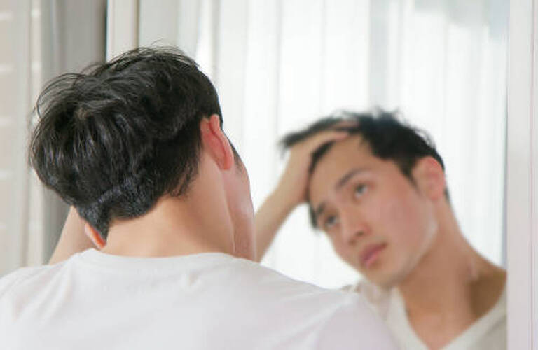 薄毛・抜け毛｜育毛鍼×ヒト幹細胞培養液施術